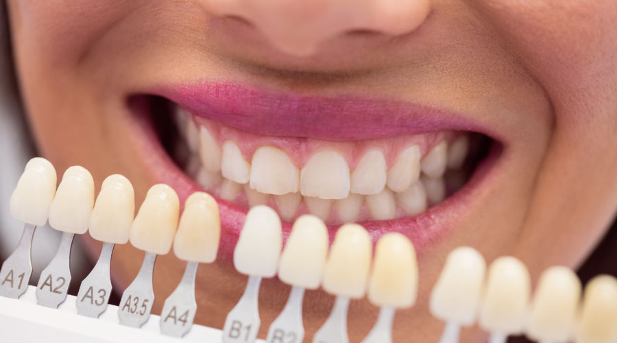 Tipos y beneficios de la prótesis dental