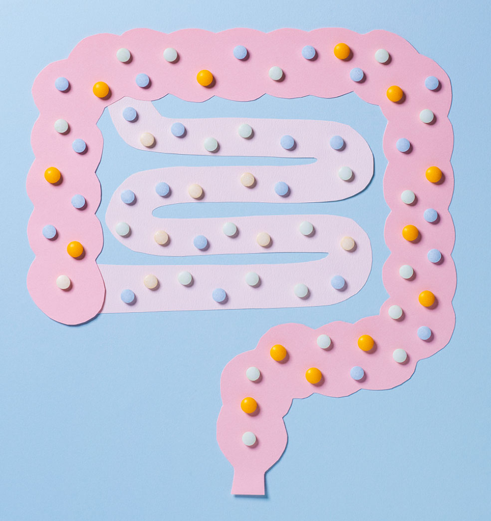 Cómo prevenir el cáncer colorrectal (CCR)?