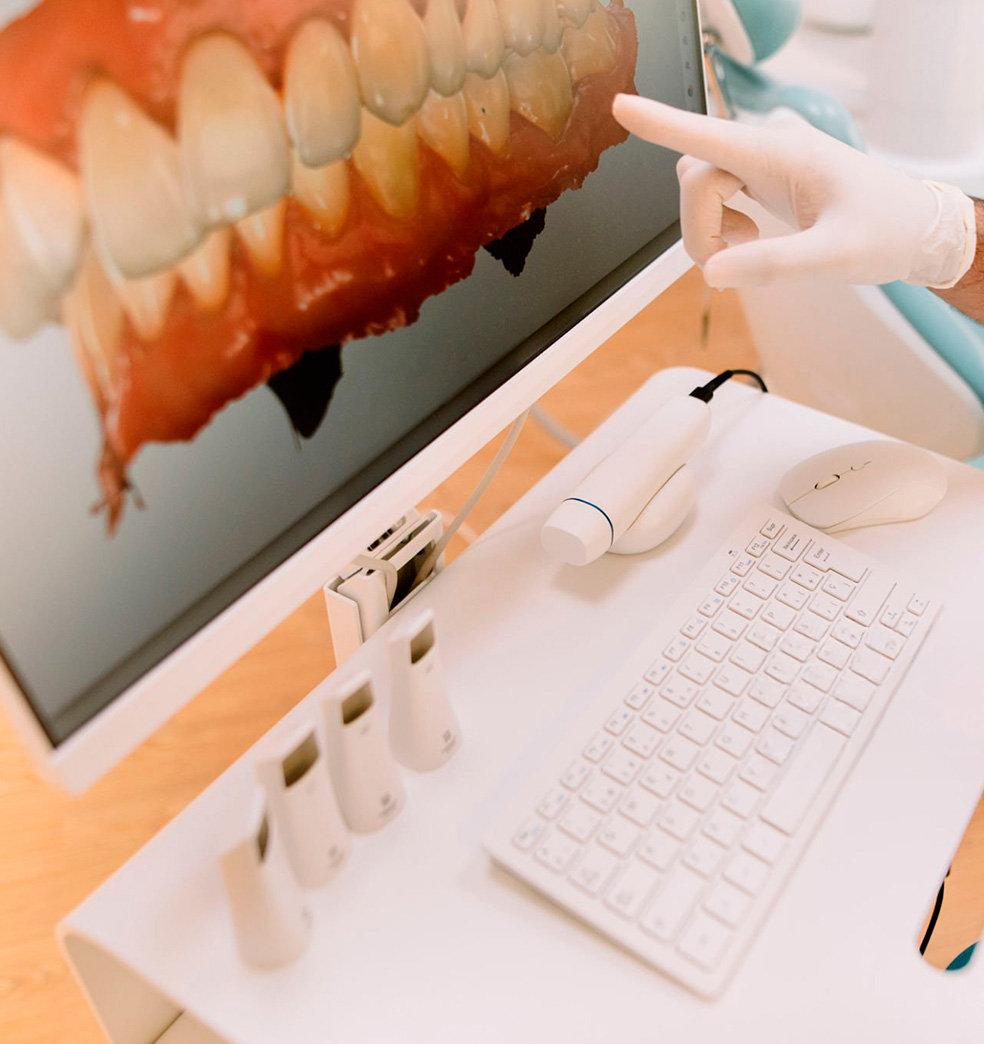 Escáner intraoral: Precisión con rapidez y comodidad