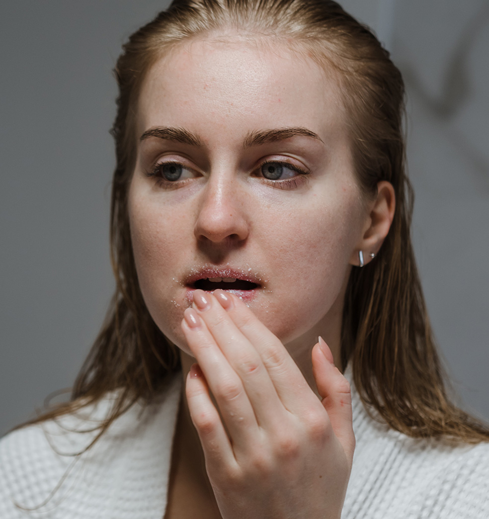 Labios secos y agrietados