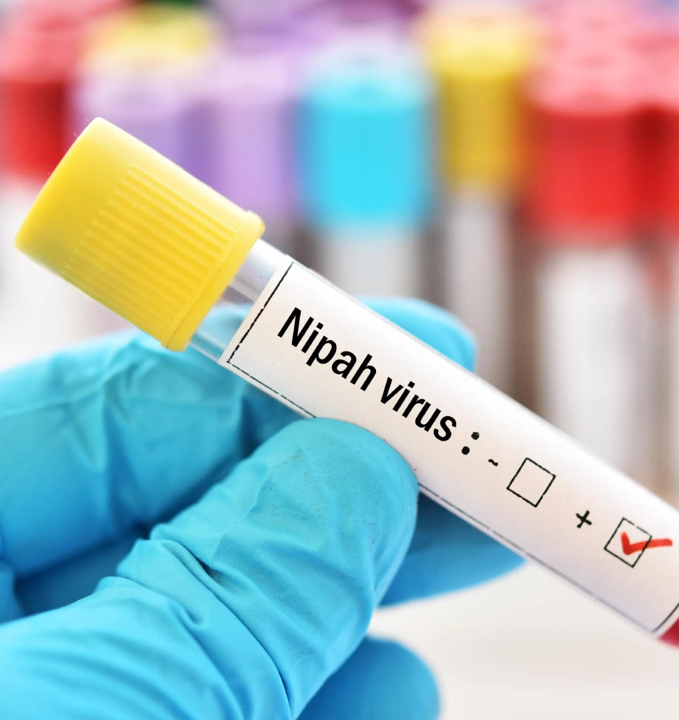 Otra amenaza latente: “El virus del nipah”