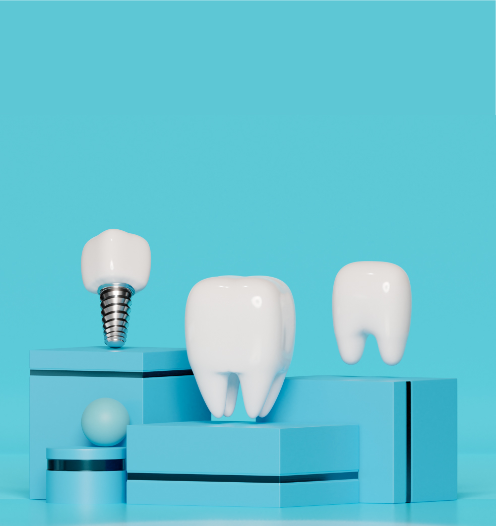 No posponga la colocación de implantes dentales