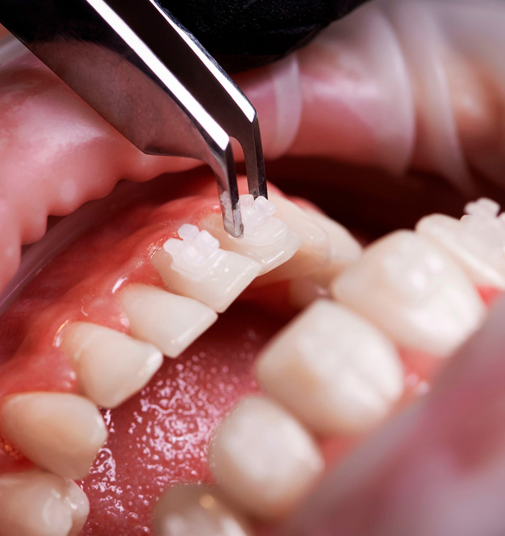 Procedimientos para la salud y estética mental 