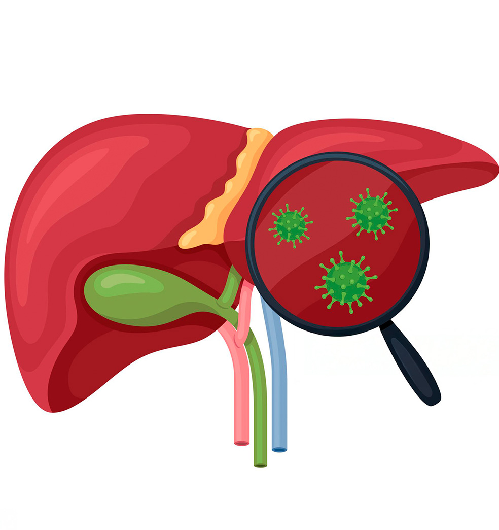 Todo sobre: hepatitis