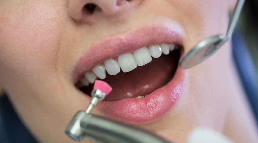 Qué tratamientos odontológicos puede realizarse después de una ortodoncia