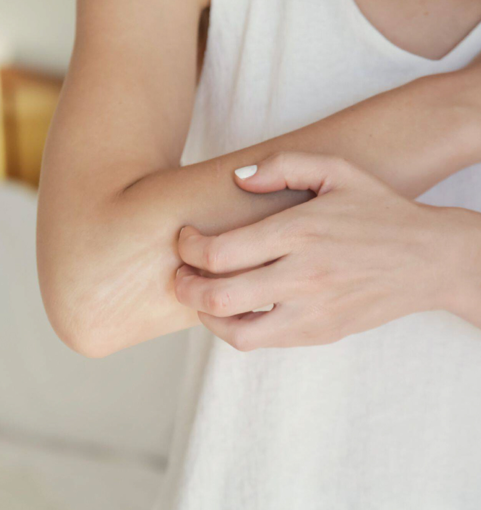 Urticaria colinérgica: Comezón al realizar ejercicio?