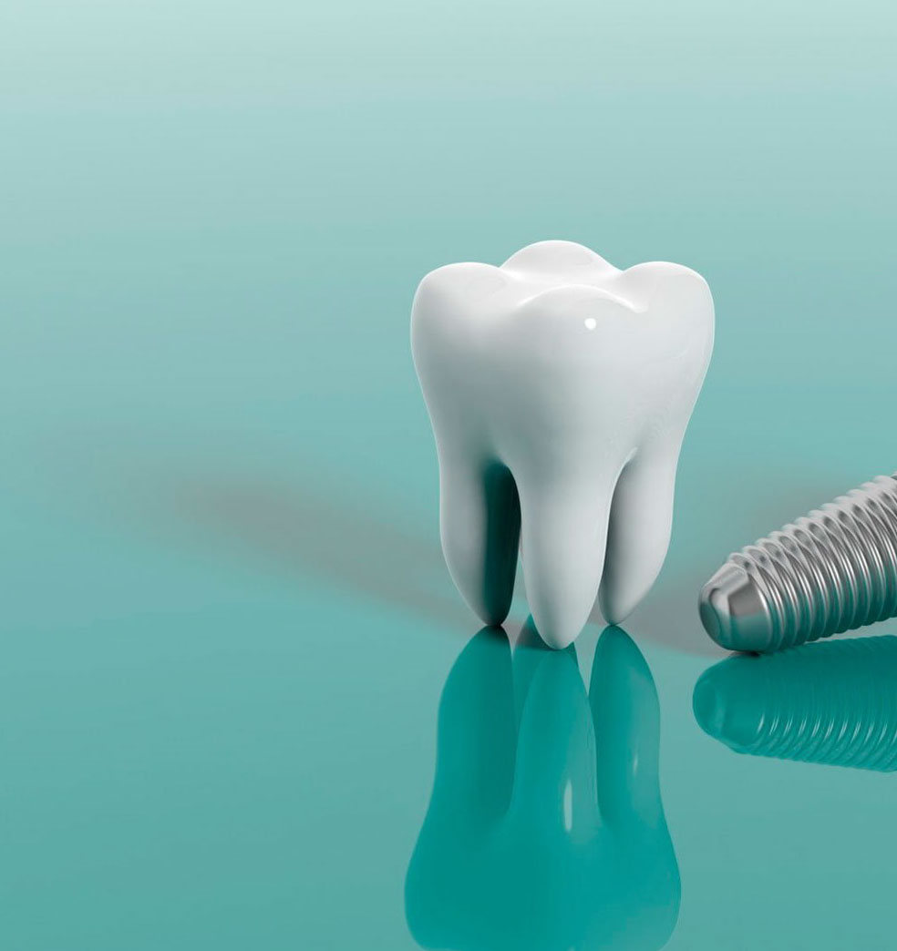 Ventajas y desventajas de los implantes dentales bifásicos y monofásicos